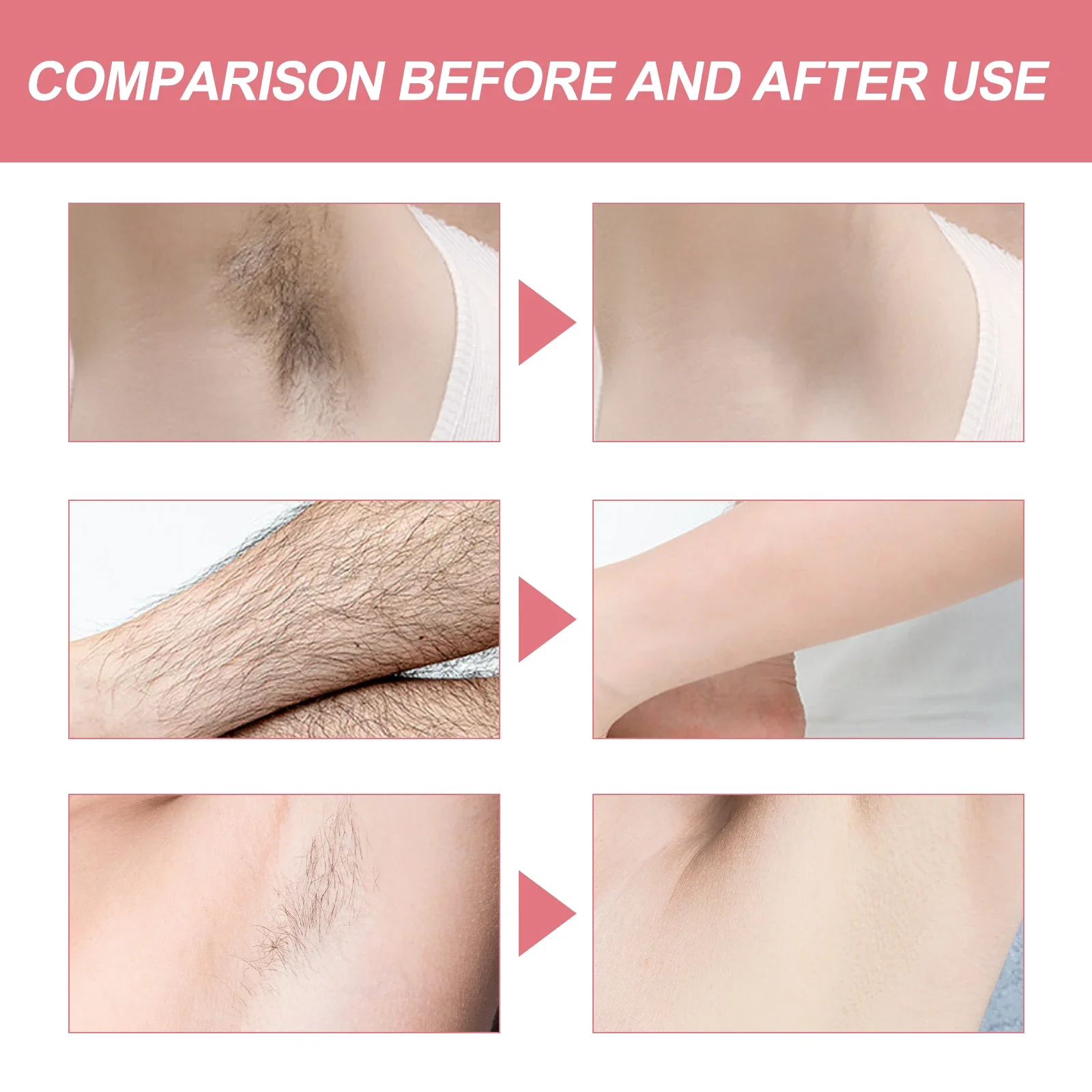Gentle Moisturising Honey Hair Removal Cream For Smooth Skin_voghion.com