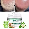 Herbal Anti Crack Foot Cream Heel Cracking Repair Products Exfoliation Dead Skin Removal Softening Moisturize Smooth Skin Care