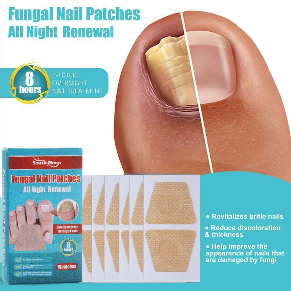 

South Moon Nail Treatment Patch Anti Fungal Nail Correction Stickers Ingrown Toenail Care Paronychia Anti Infection Repair Patch