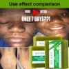 Aloe Brightening Soap Bar, Reduce Dark Spots, Sun Spots, Acne, Oil Control, Clean Stains, Exfoliation, For Face and Body 6