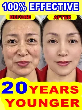 20 years younger, wrinkles disappear 1