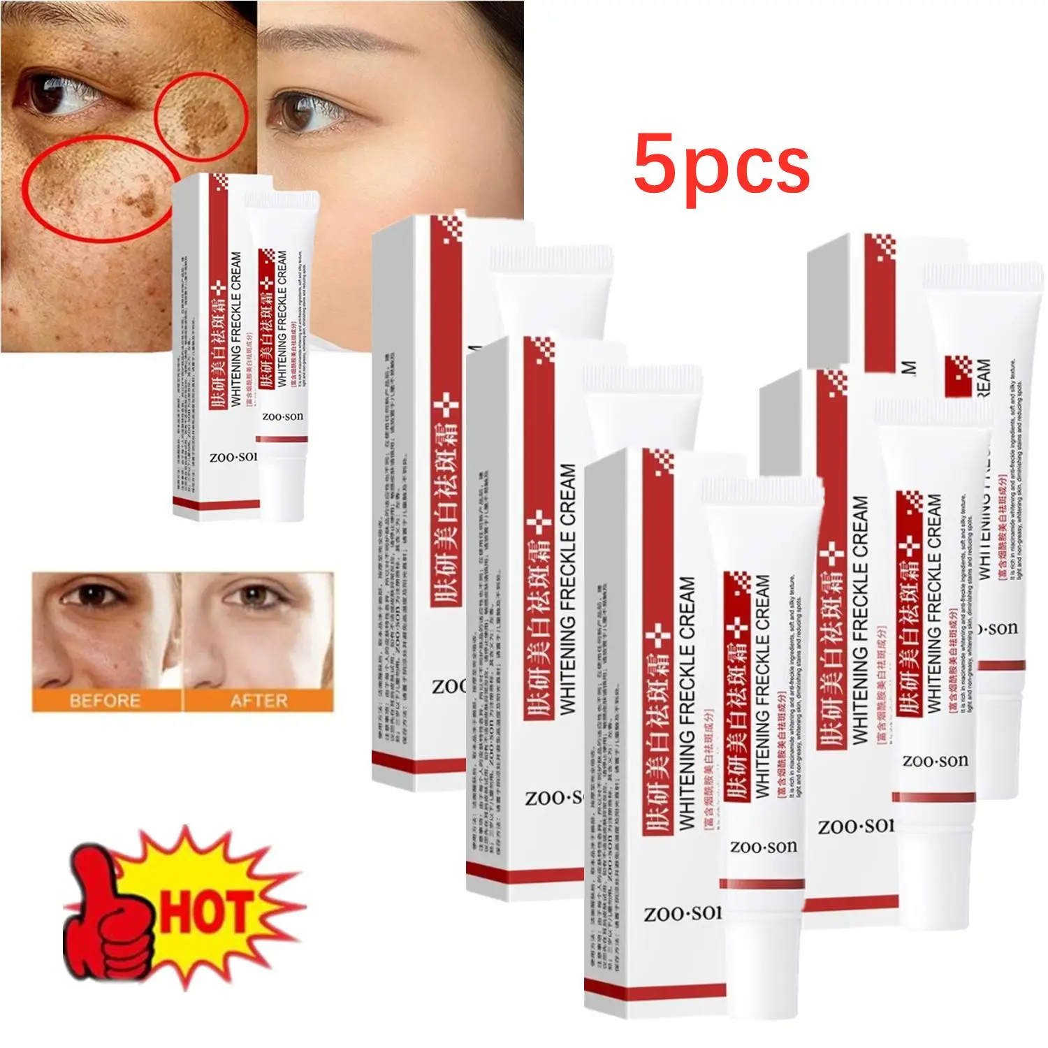 

5X Effective Whitening Freckle Cream Remove Dark Spots Anti Freckle Cream Fade Pigmentation Melasma Brighten Creams Skin Care