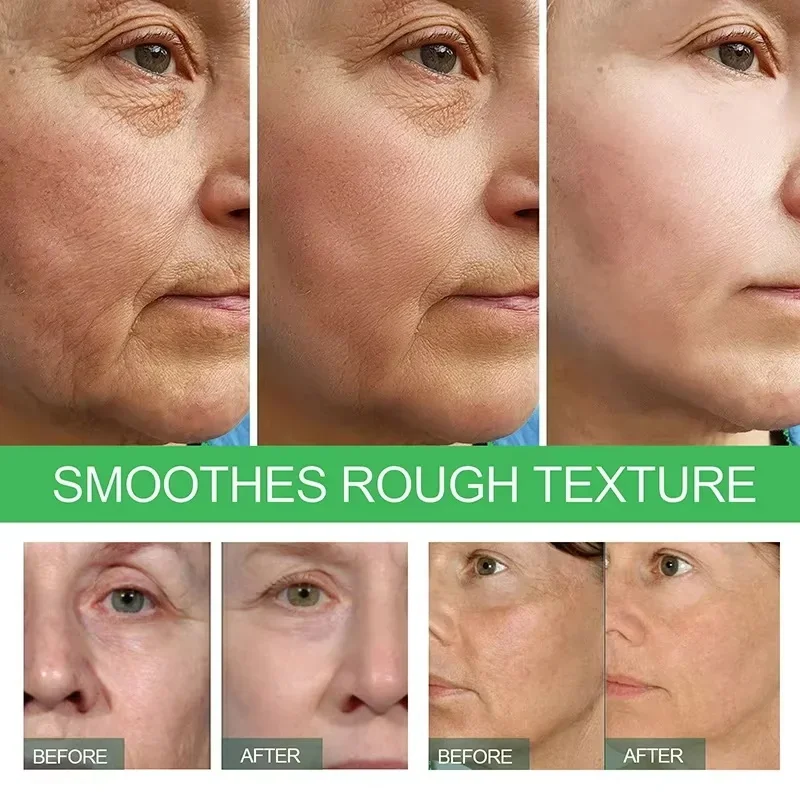 Retinol Anti-Wrinkle Cream Anti-Aging Firming Lifting Fade Fine Lines Deep Hydration Instant Smoothing Korean Skincare Cream 40g 3