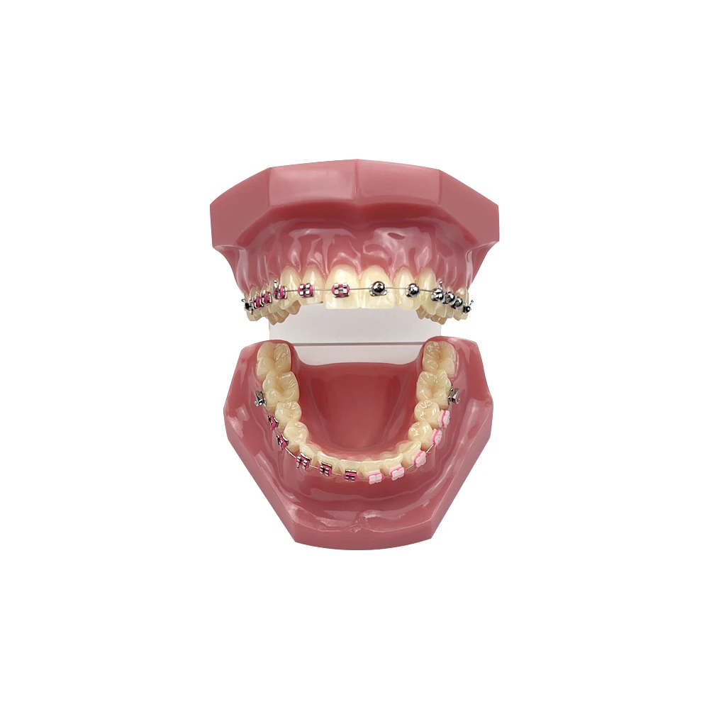 歯科歯模型矯正模型ブラケット付き 1/4 球形セルフロック式教育研究用