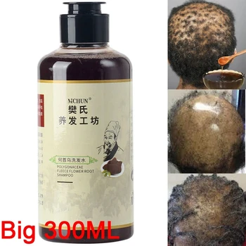 Shampoo Anticaduta 300ml Africa Women per Uomini e Donne: Trattamento per la Crescita dei Capelli e Contro l'Alopecia da Trazione - Elimina le Parrucche