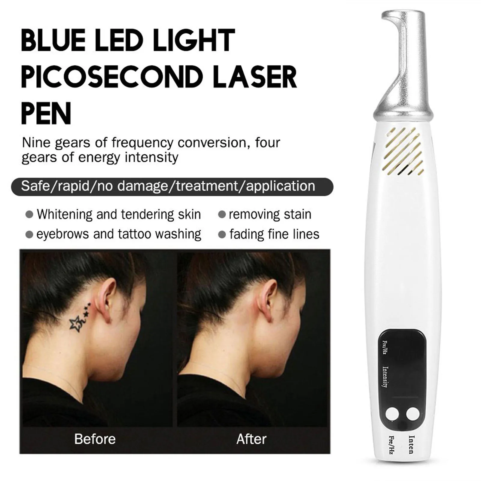 Handheld Picosecond Laser Pen Tattoo Scar Freckle Removal Machine Skin Beauty Device 1