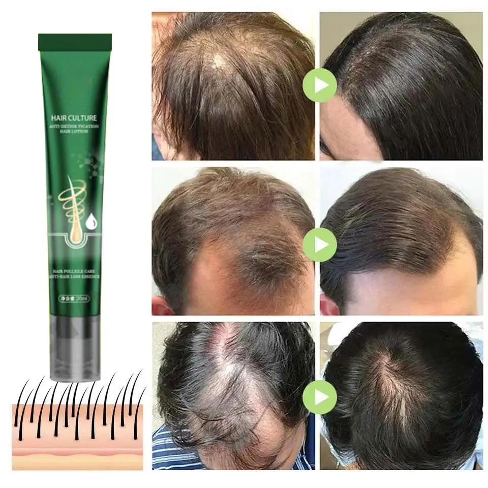 Description Picture 4 of itemHair Growth Oil Fast Hair Growth Effective Baldness Repair Hereditary Hair Loss Postpartum Hair Loss Seborrheic Hair Loss
