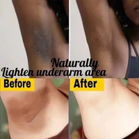 Body Whitening Cream Remove Thigh Inner Joint Dark Melanin Knee Bleach Private Part Whiten Lighten Moisturize Brighten Body Care 2
