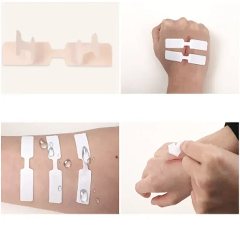 5pcs/lot 45*10mm New Stitch-free Band-aid Outdoor Quick Wound Suture Patch Without Stitching Tape Survival Gear First Aid Kits