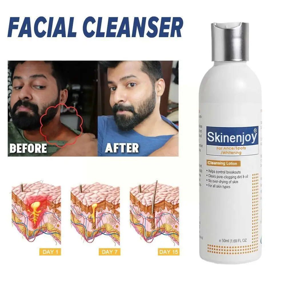 

Skinenjoy Whitening Facial Cleanser Brighten Skin Tone Whitening Face Removal Smooth Fade Refreshing Wash Cleaning Foam Chl E1S8