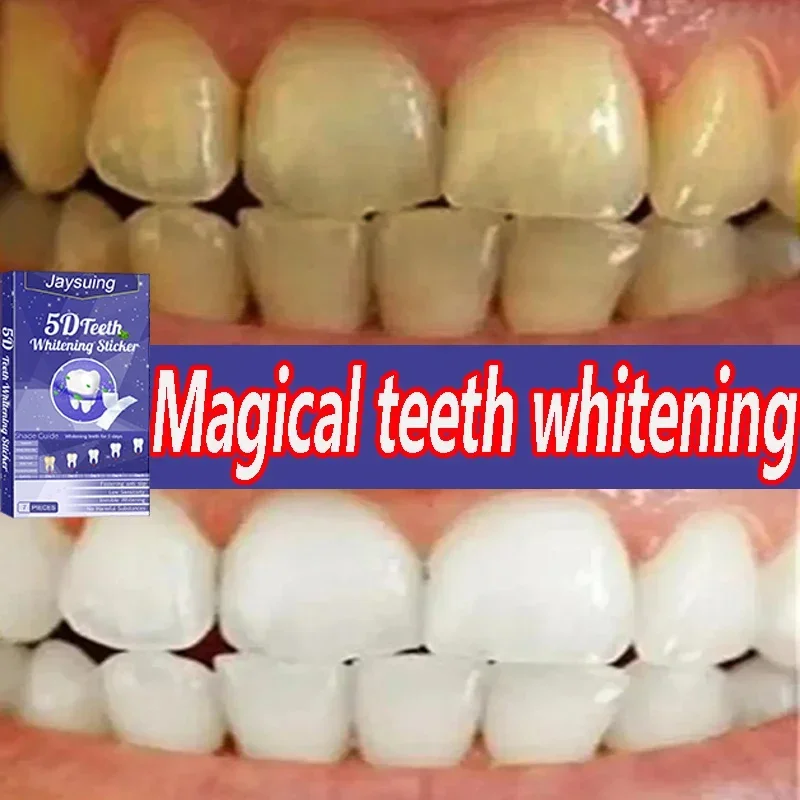 5D Whitening Teeth Stickers Gel Whitening Strips Stain Removal Oral Hygiene Care Strip Dental Bleaching Clean Oral Hygiene Teeth