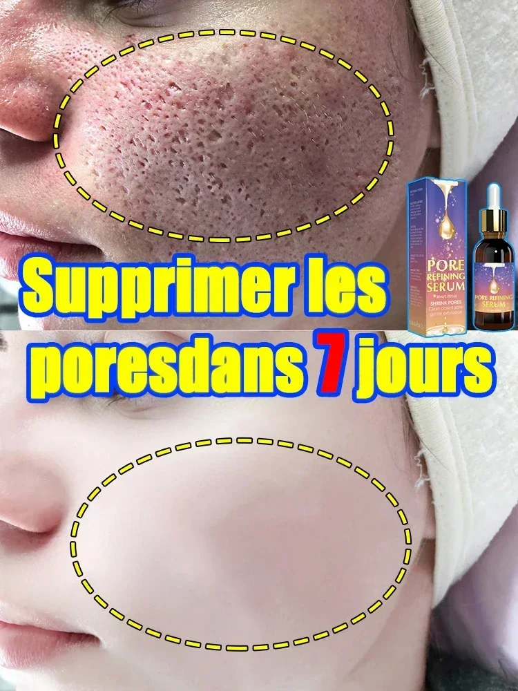 Pore Shrinking serum Essence Shrinking Pores Lactobionic Acid Shrinking Pores Facial Essence Firming Facial Pores Repair