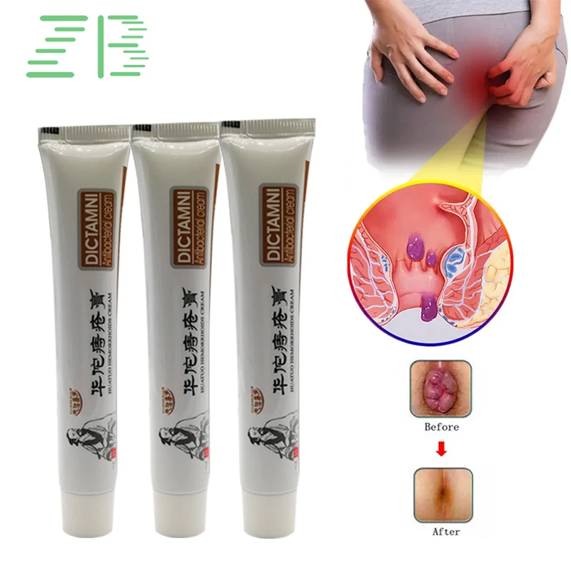 Hemorrhoids Removal Cream Internal External Hemorrhoid Treatment Herbal Ointment Anal Fissure Swell Relief Medicine 3Pcs Hemorrhoids Treatment Cream