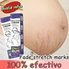 Eliminate Red White Old Stretch Marks Cream For Pregnancy Postpartum Skin Care Gel 5