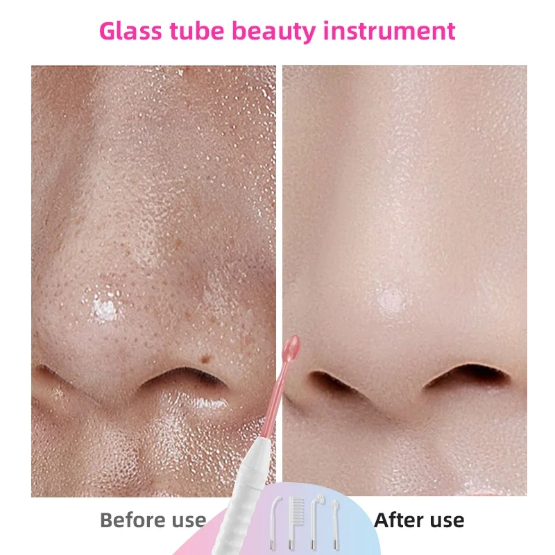 4-in-1 High-frequency Electrotherapy Glass Tube for Acne Removal and Spot Refinement Skin Hydrotherapy Facial Treatment Device 5