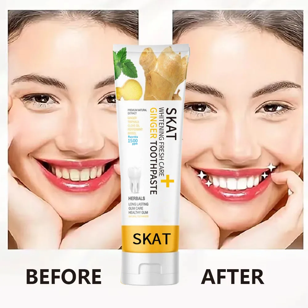 Ginger Mint Whitening Toothpaste Cleans Mouth Stains Remove Fresh Breath Soft Foam Protects Gums Whitening Teeth Oral care