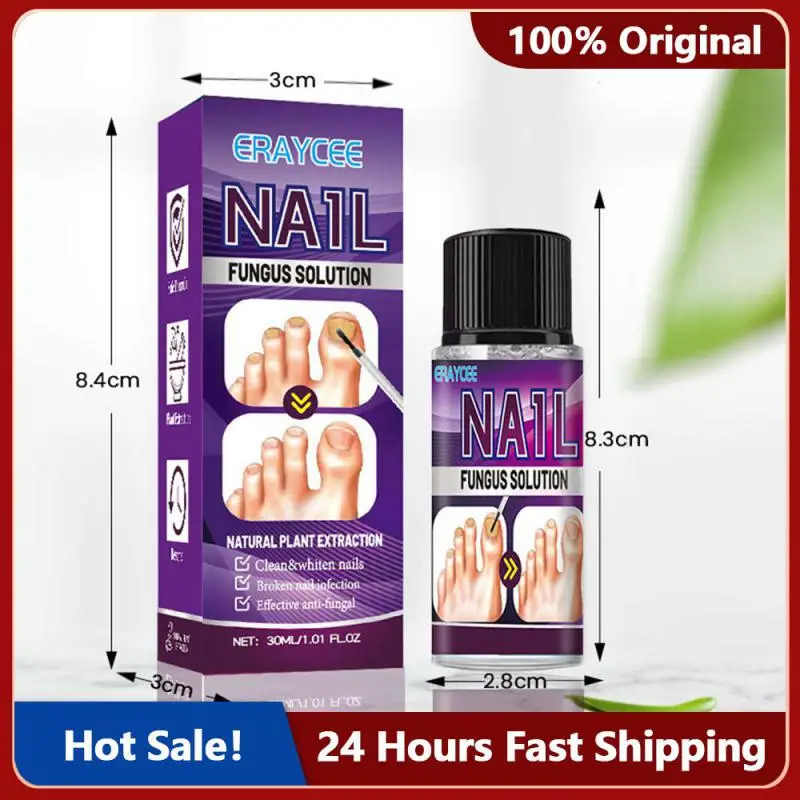 

30ML Plant Extract Impatiens Onychomycosis Antibacterial Liquid Bright Armor Armor Fungal Repair Grey Nail Antibacterial Liquid