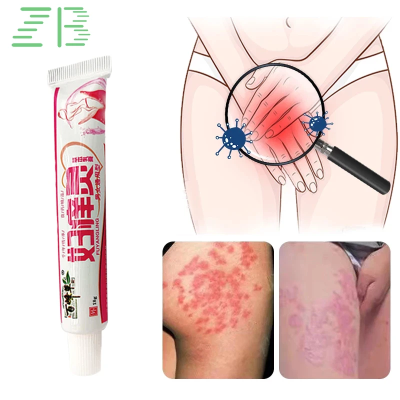 

18g ZB Pussy Anti-itch Cream Antibacterial Itching Cream For Eczema Genitals Remove Odor Dermatitis Psoriasis Herbal Ointment