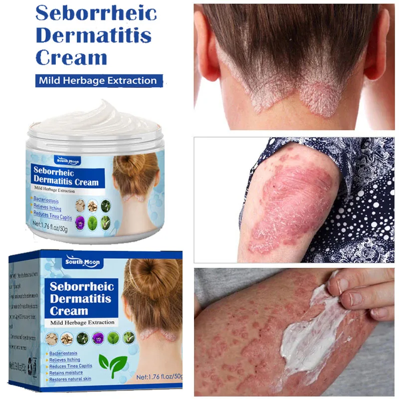17 Best Eczema Creams 2022 For Soothing Itchy, Red FlareUps Dermatologist