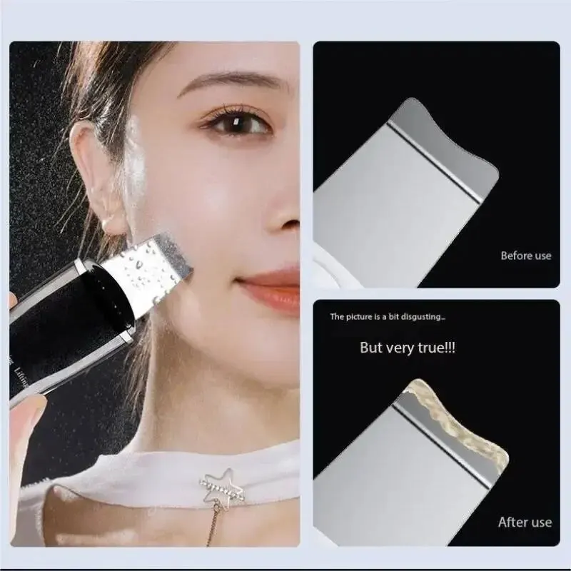 Blackhead Remover Cleaning Pore Shrinking Beauty Device Dead Skin Acne Scalper Facial Cleanser