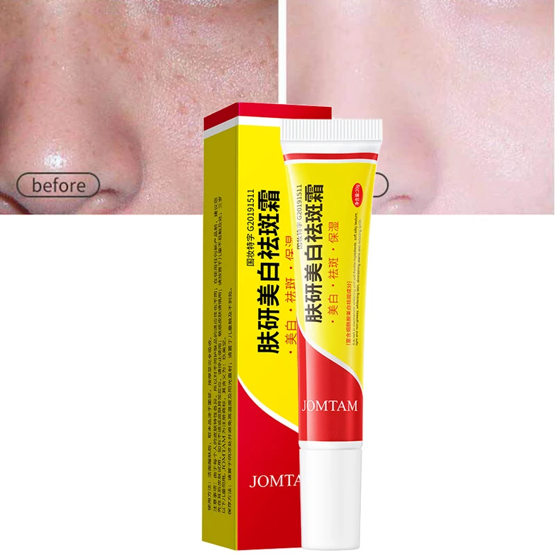 

Effective Whitening Freckle Cream Remove Melasma Acne Spot Pigment Melanin Dark Spots Pigmentation Moisturizing Whitening Cream