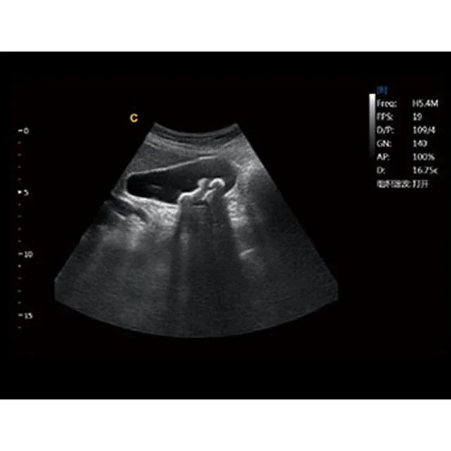 Рисунок 4 - CHISON Ebit 30, медицинские ультразвуковые инструменты