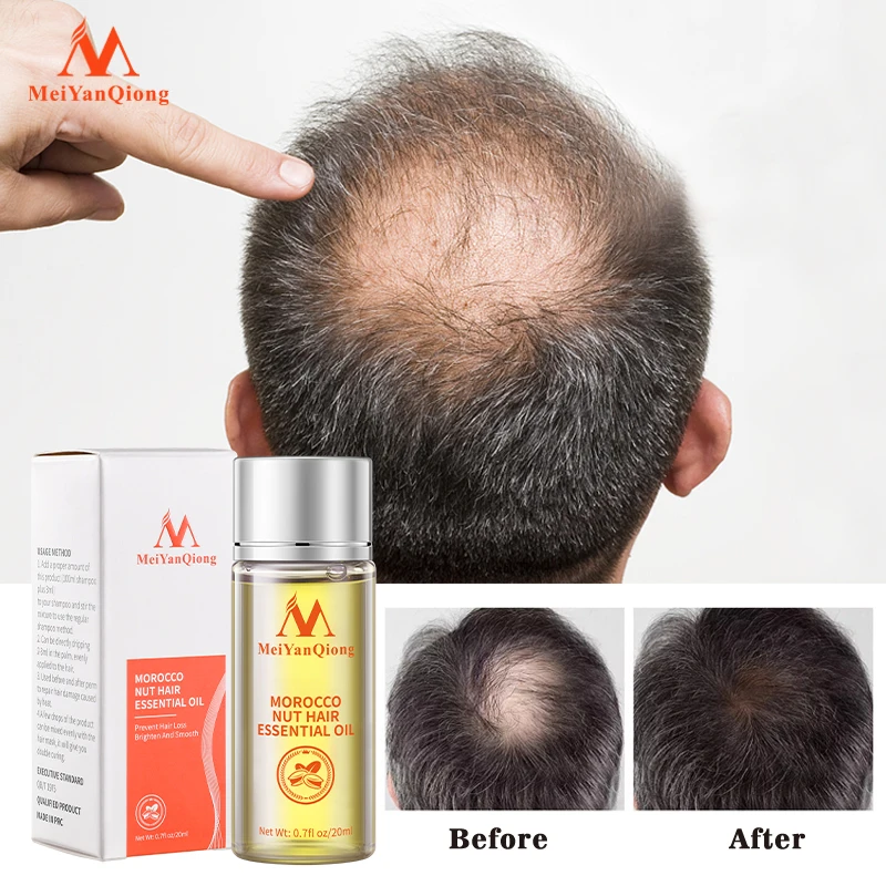 Argan Hair Oil Fast Hair Growth Essential Oil Natural Anti-hair Loss Prevent Hair Dry Soft Nourishing Frizz Damaged Repair Care