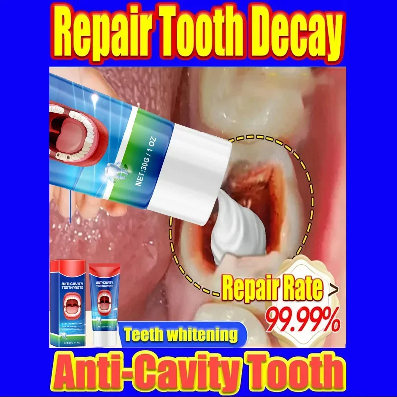 Teeth Whitening Essence Teeth Whitening Product Toothpaste Dental Caries Repair Cream Prevent Tooth Decay Protect Teeth Remove Plaque Toothache Relieve Periodontitis Brighten