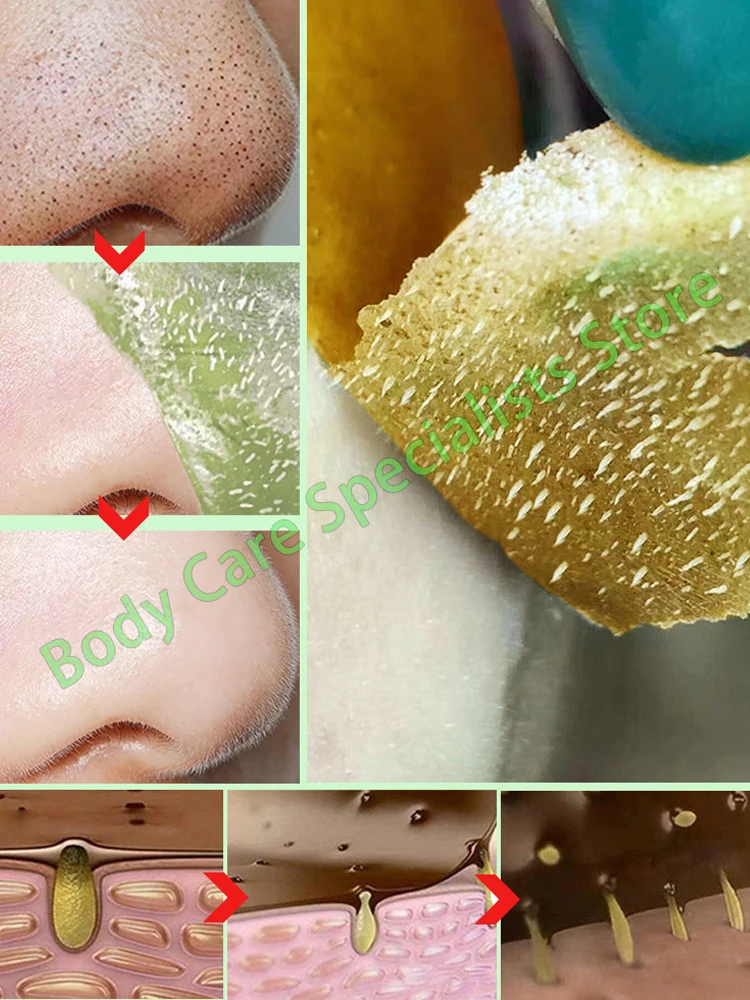 

Nose Blackhead Remover Mask Nasal Strips Black Head Nose Dot Spot Peel Off Sticker Face Acne Whitehead Pore Cleaner Mask