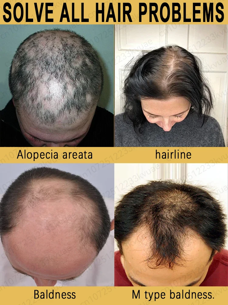 100% Natural Vegetable-based Hair Growth Essential Oil 3-day Hair Growth