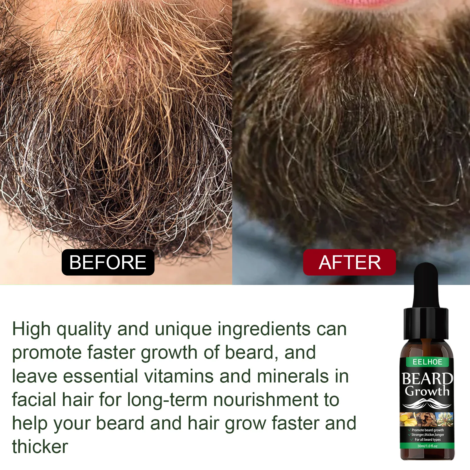 Fast Beard Growth Spray for Men Nourishing & Moisturizing Beard Enhancer Oil Promotes Mustache Growth Comprehensive Care for hair treatment