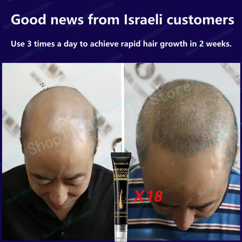 Description Picture 5 of itemAnti Alopecia Fast Hair Growth Oil Ginger Essential Serum Hairless Baldhead Increase High Hairline Natural Head Hair Essence
