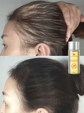  Fast Powerful Hair Growth Essence Hair Loss Products Essential Oil Liquid Treatment Preventing Hair Loss Hair Care Products 20ml 