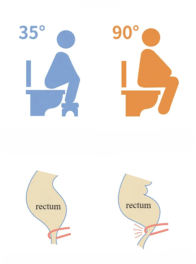 Description Picture 3 of item1PCS Toilet Squat Stool Non-slip Toilet Footrest Seat Furniture Kid Footstool Home Adult Removable Portable Bathroom Accessories