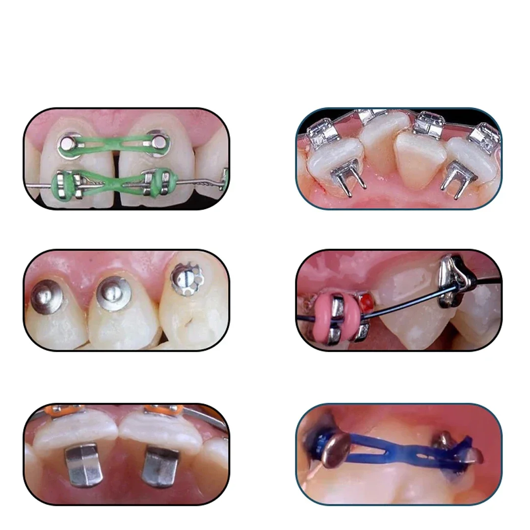10Pcs Dental Orthodontic Bite Turbo Bite Opener Bondable Hinge Tongue Tamers Lingual Buttons Traction Hook Orthodont Materiales