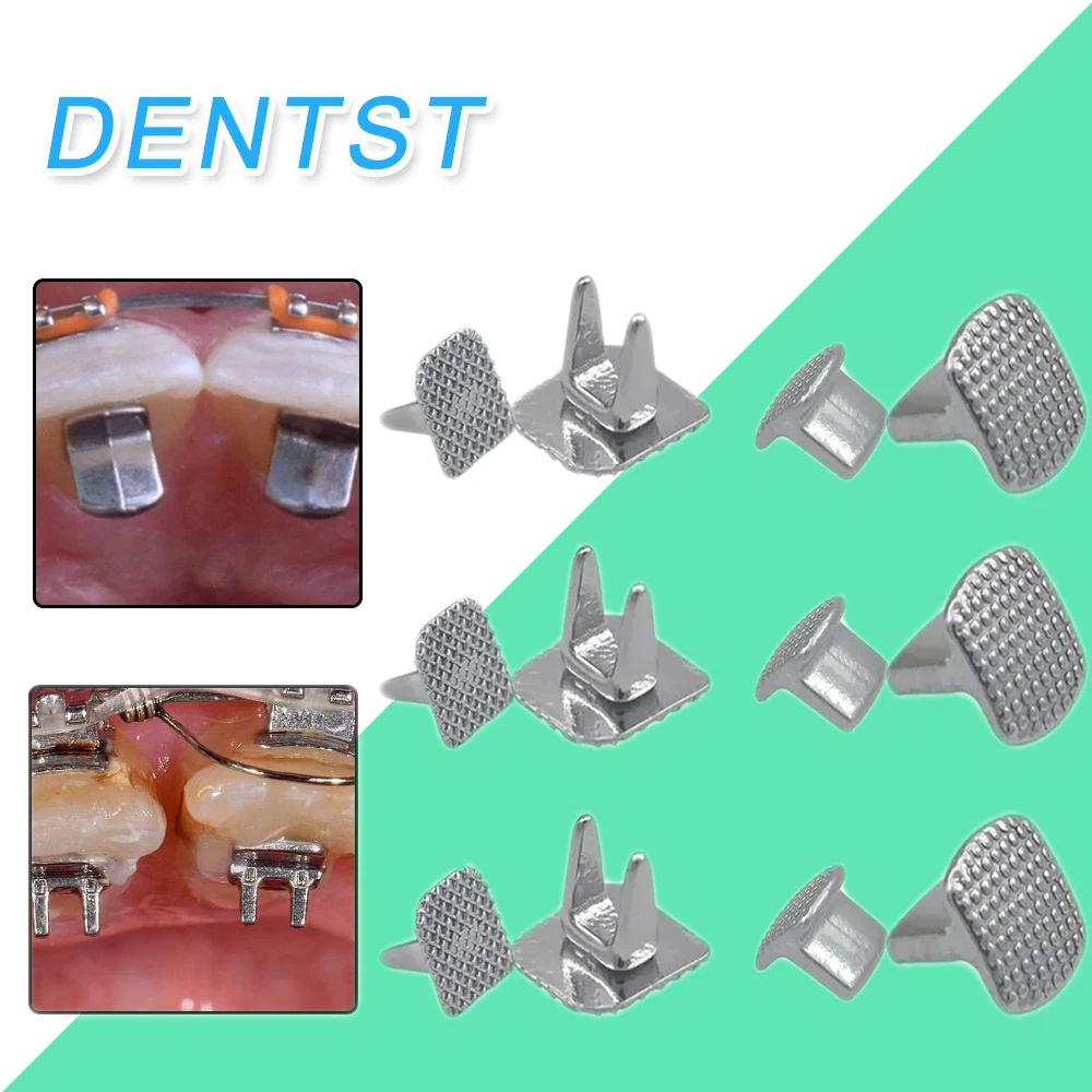Tube Buccal Orthodontique 1ère Molaire ROTH 022 - Lot De 4 - Non-Con Monobloc Collable