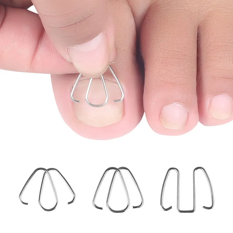 3 Pairs Front Nail Hook/rubber Band Nail Art Ingrown Toe Nail