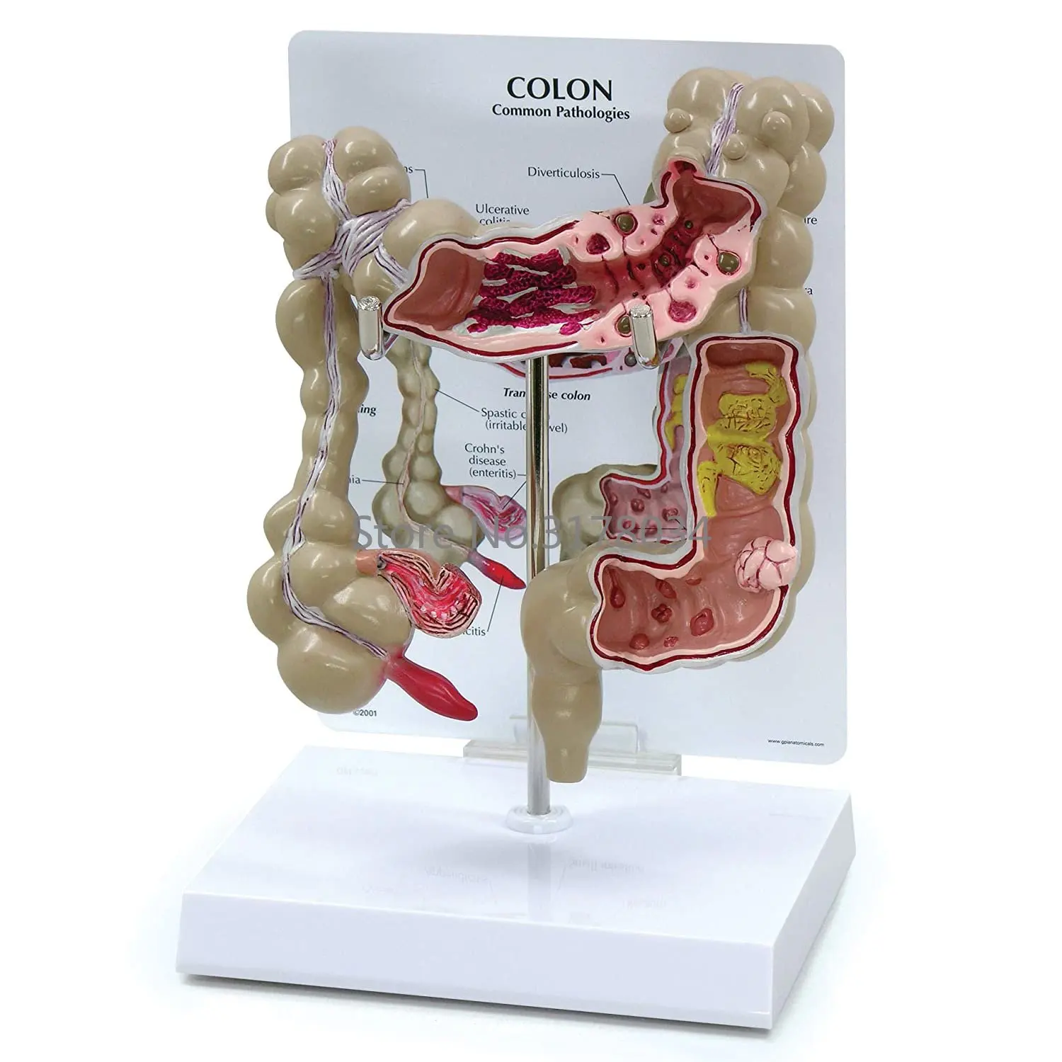 Анатомия человеческого тела, точная копия толстой кишки с общими патологиями для врачей, офисный обучающий инструмент
