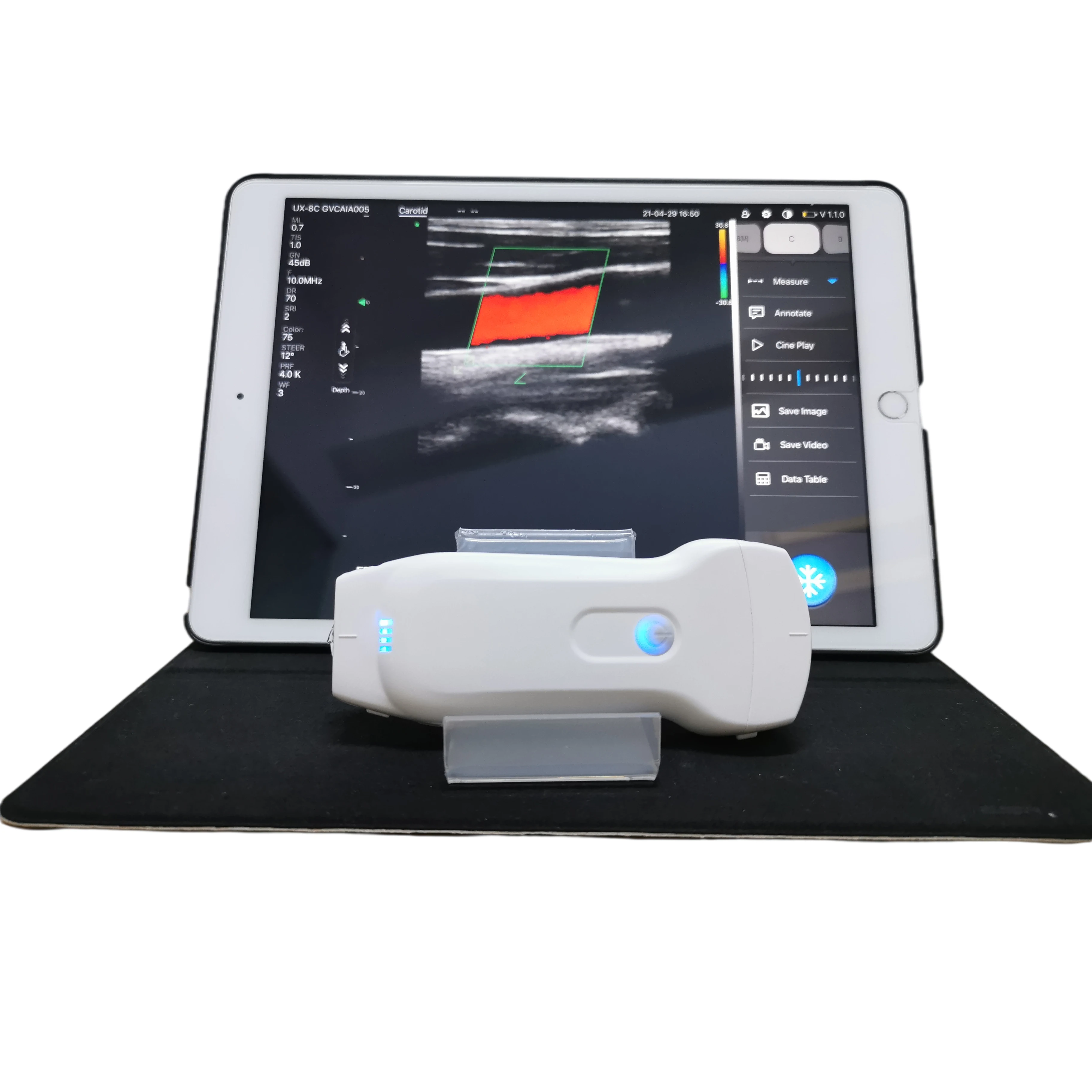 

Highest Cost-effective Double Probes Wireless Color Doppler Ultrasound Scanner ultrasound probe wireless linear