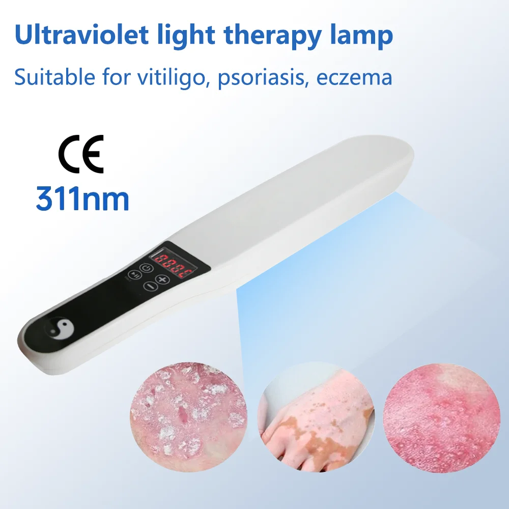 Uvb 311nm Narrow Band Light Therapy Lamp Instrument For Psoriasis Vitiligo Skin Disease Treatment Anti-White Spot Of Uvb Lamp 2