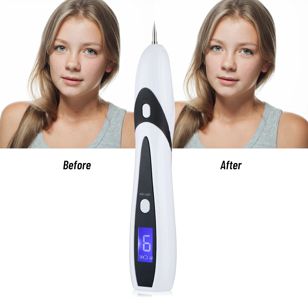 Plasma Jet Pen Electric Anti Wart Cauterizer Berrugas Eliminator Laser Freckles Removal Papilloma Remedy Mole Removes Polka Dots
