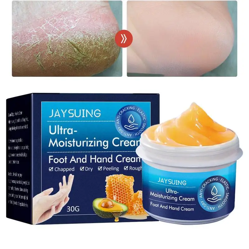 Hand Cream Extremely Dry Cracked Skin Repairing Hand Foot Cream