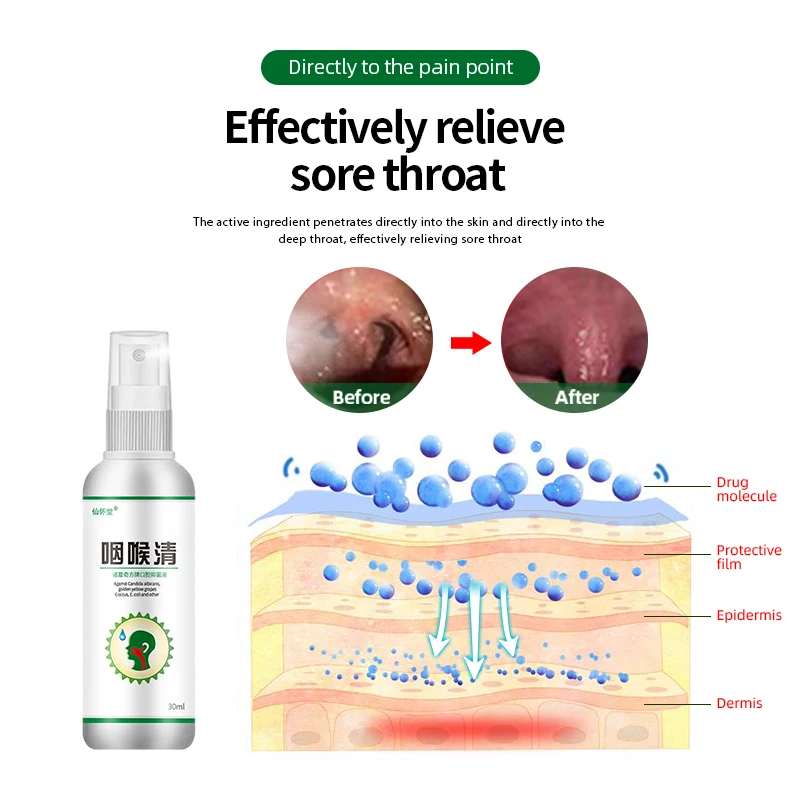Sore Throat Cough Spray Chronic Oral Pharyngitis Throat Inflammation Medicine Itchy Cleaner Care Honeysuckle Wild Chrysanthemum