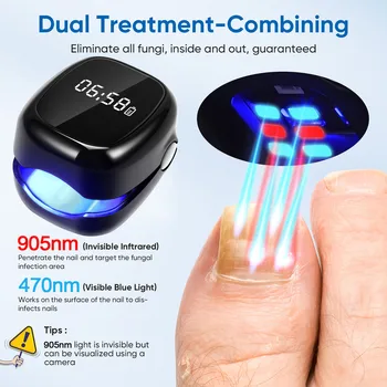 Fungo delle unghie Onicomicosi Dispositivo laser Riparazione LED 905nm Luce IR 470nm Luce blu Strumenti per la pulizia anti-fungini delle unghie delle mani o dei piedi