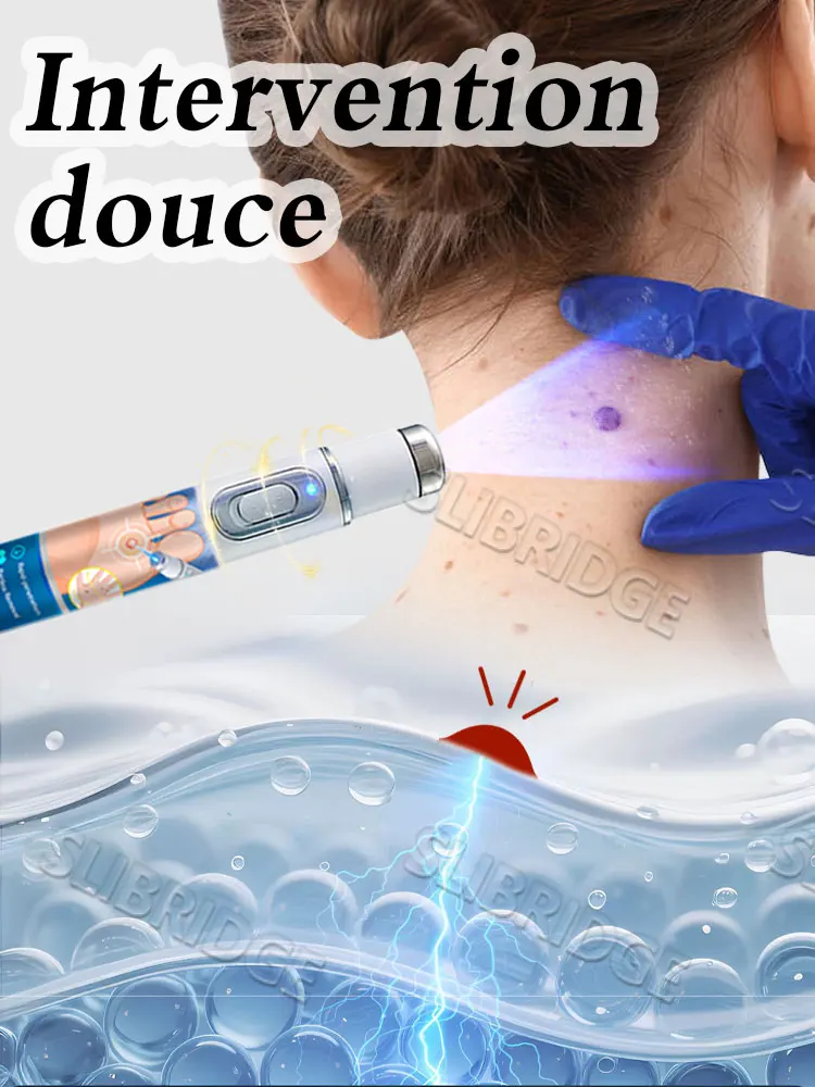 Latest Upgraded Blue Light Pen, Best-selling Wart Care_voghion.com