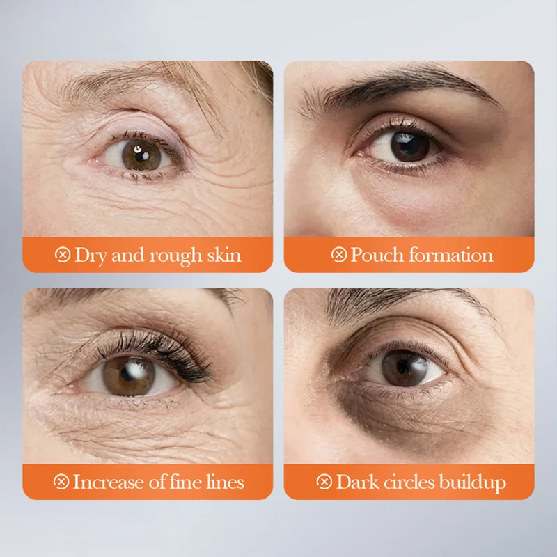 5 Pairs SADOER Black Crystal Collagen Eye Mask Anti-wrinkles Anti-aging Moisturizing Anti Dark Circles Eye Patches Gel Masks