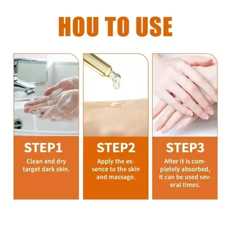 Dark knuckles whitening serum Elbows Armpit Beaching SerumWoman Private Part Skin Removal Dark Knuckles Strong Whitening Serum 4