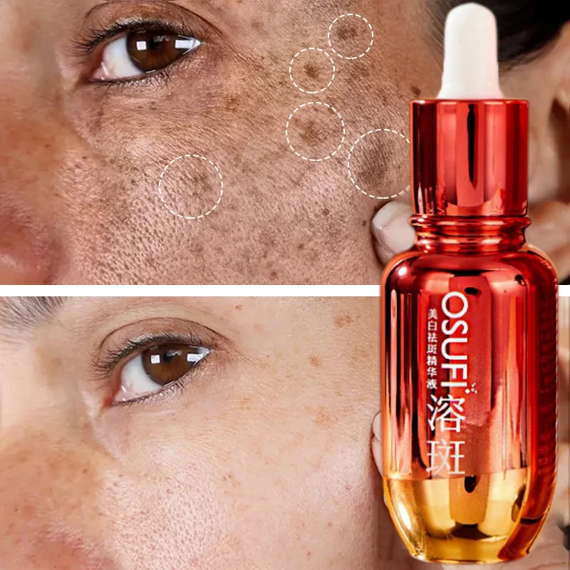 

Niacinamide отбеливающая Сыворотка для лица, удаление мелазмы, солнцезащитные пятна, осветление пигментации, кожа, уход 50 мл