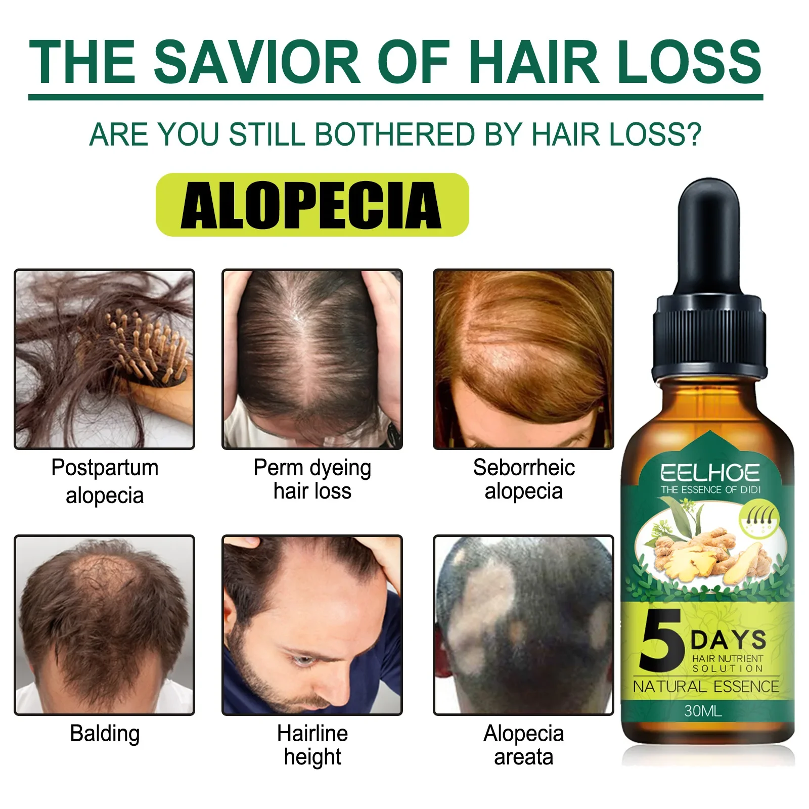 

Sdotter New Anti Alopecia быстрое масло для роста волос Имбирная сыворотка без волос увеличивающая рост волос