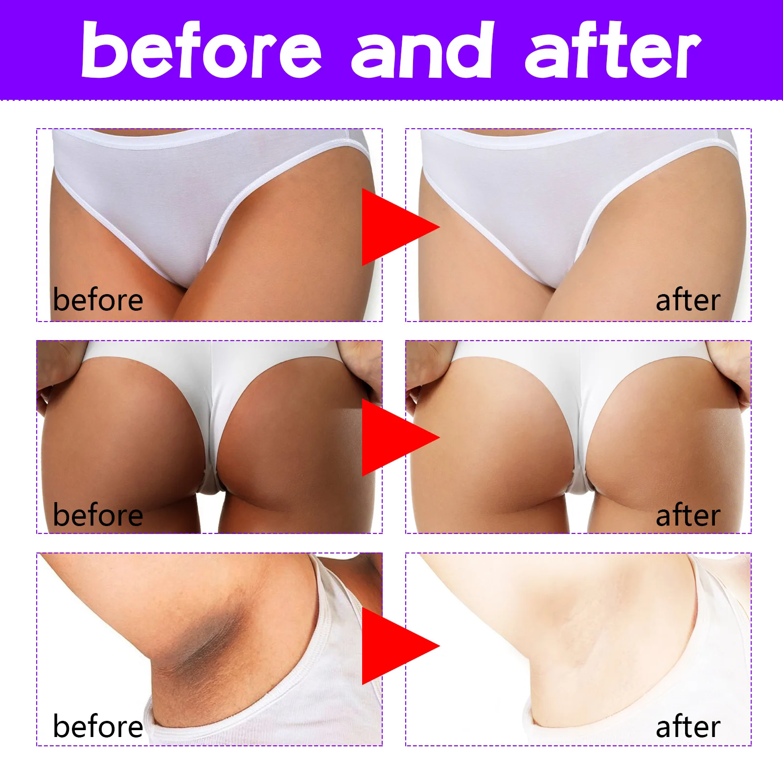 Inner Thigh Whitening Cream Private Parts Underarm Bleaching Cream Whiten Butt Knee Brighten Melanin Intimate Dark Skin Care 60g 6